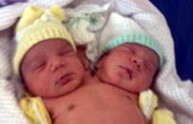 Brasile, nasce un bambino con due teste: è perfettamente in salute