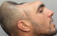 L'uomo con metà testa, ecco i motivi della lesione (VIDEO)