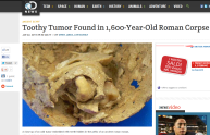 Lo strano tumore ritrovato in un cadavere di 1600 anni fa