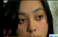 Yaritza Oliva, la ragazza che piange sangue (VIDEO)