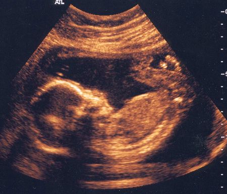 feto maschio